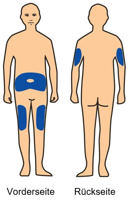 A picture containing joint, illustration

Description automatically generated