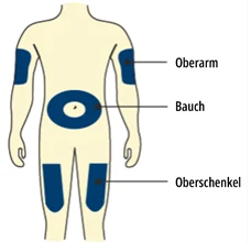 Bild 15