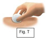 Bild 41
