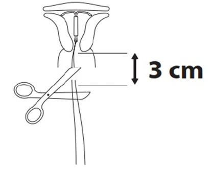 Grafik 1