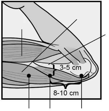 Canvas 41