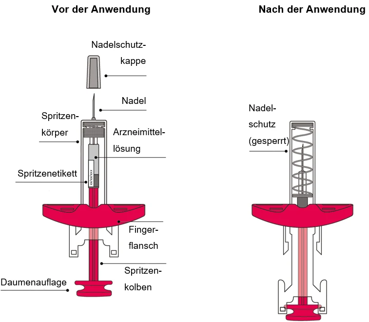 Diagram of a device with a spring

AI-generated content may be incorrect.