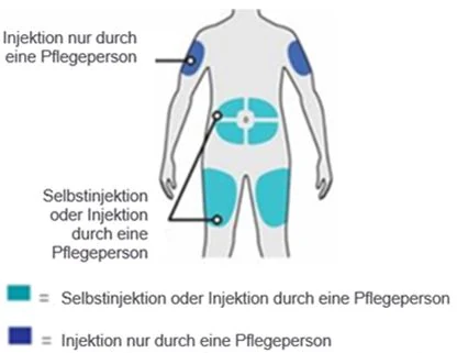 Bild 113