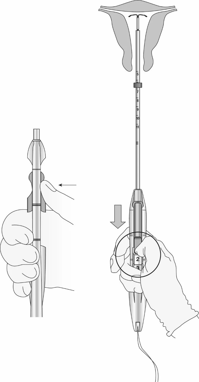 Kép 214