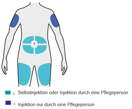 Bild 35