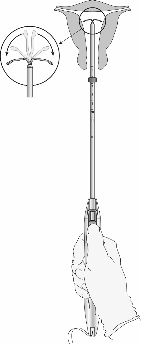 Kép 212