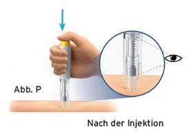 Bild 33